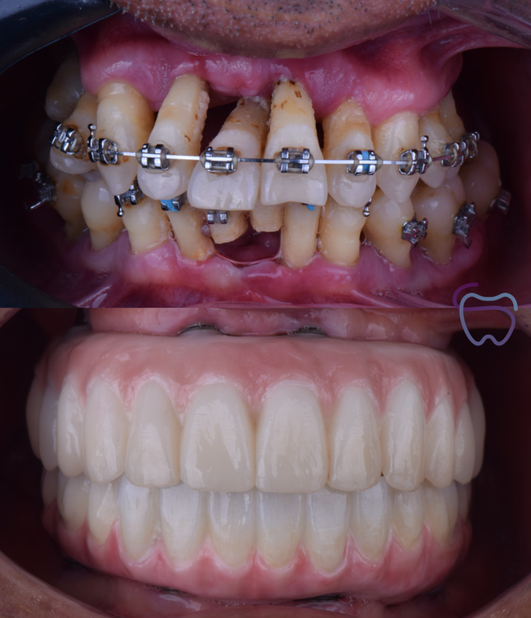 Resultado dental antes y después
